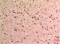 Immunohistochemical analysis of paraffin-embedded Human Brain Tissue using Beclin-1 Mouse mAb diluted at 1:200.