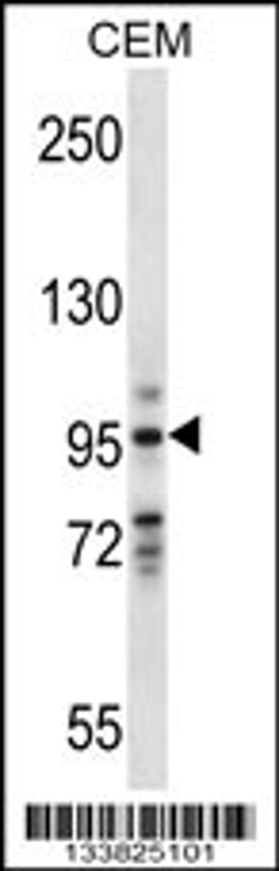 Western blot analysis in CEM cell line lysates (35ug/lane).