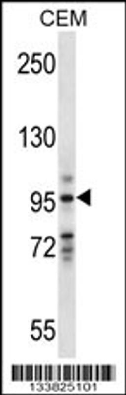 Western blot analysis in CEM cell line lysates (35ug/lane).