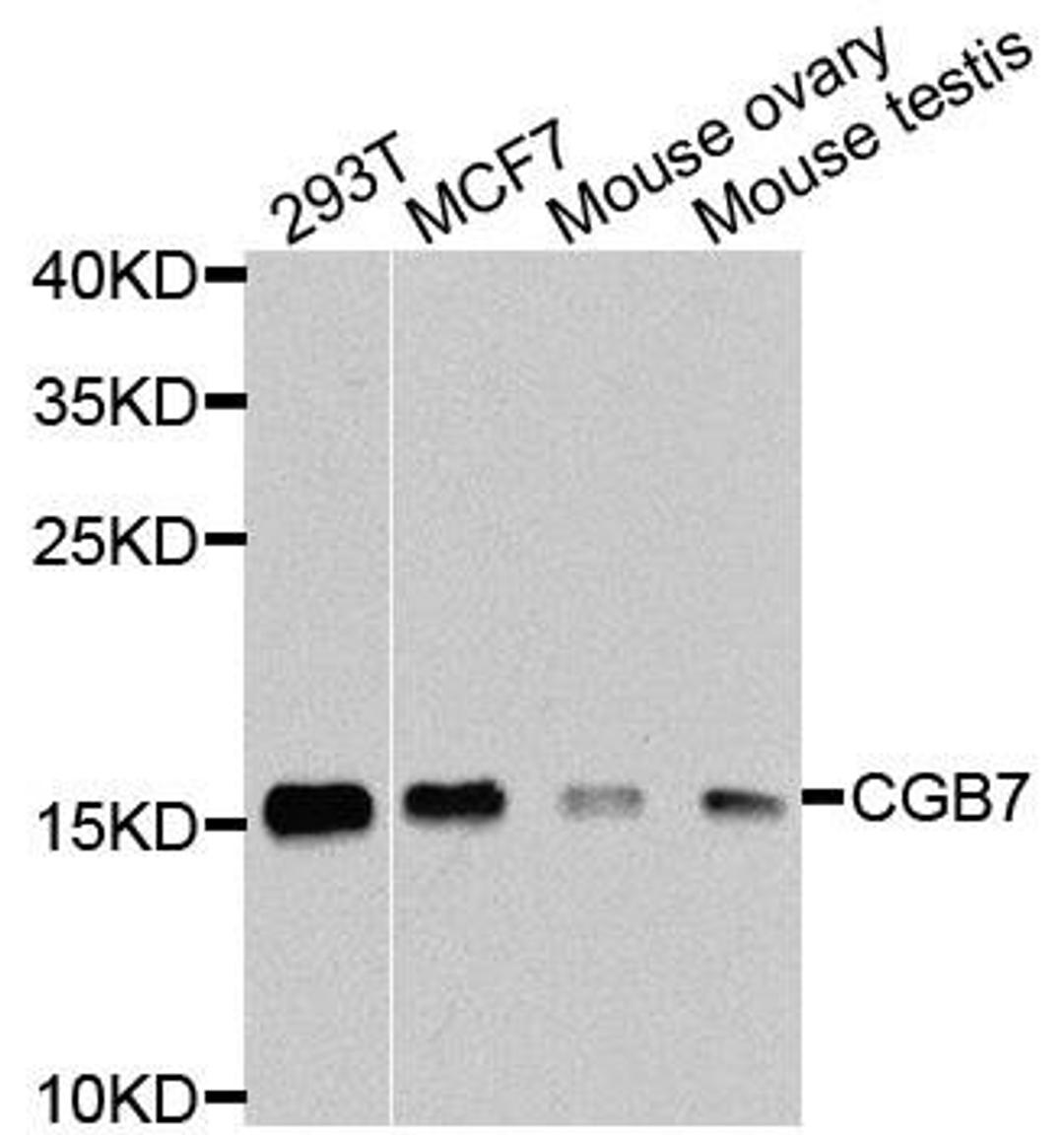 Western blot analysis of extracts of various cells using CGB7 antibody