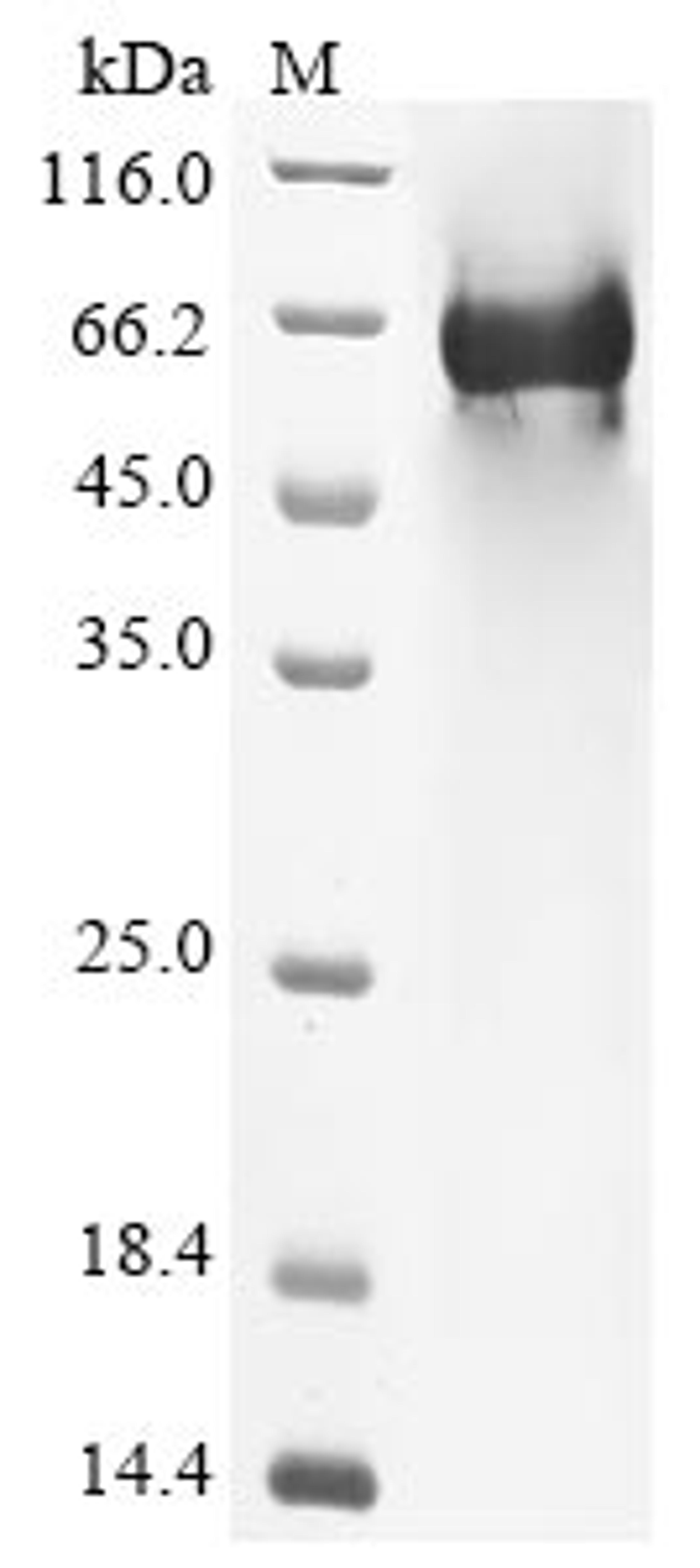 (Tris-Glycine gel) Discontinuous SDS-PAGE (reduced) with 5% enrichment gel and 15% separation gel.