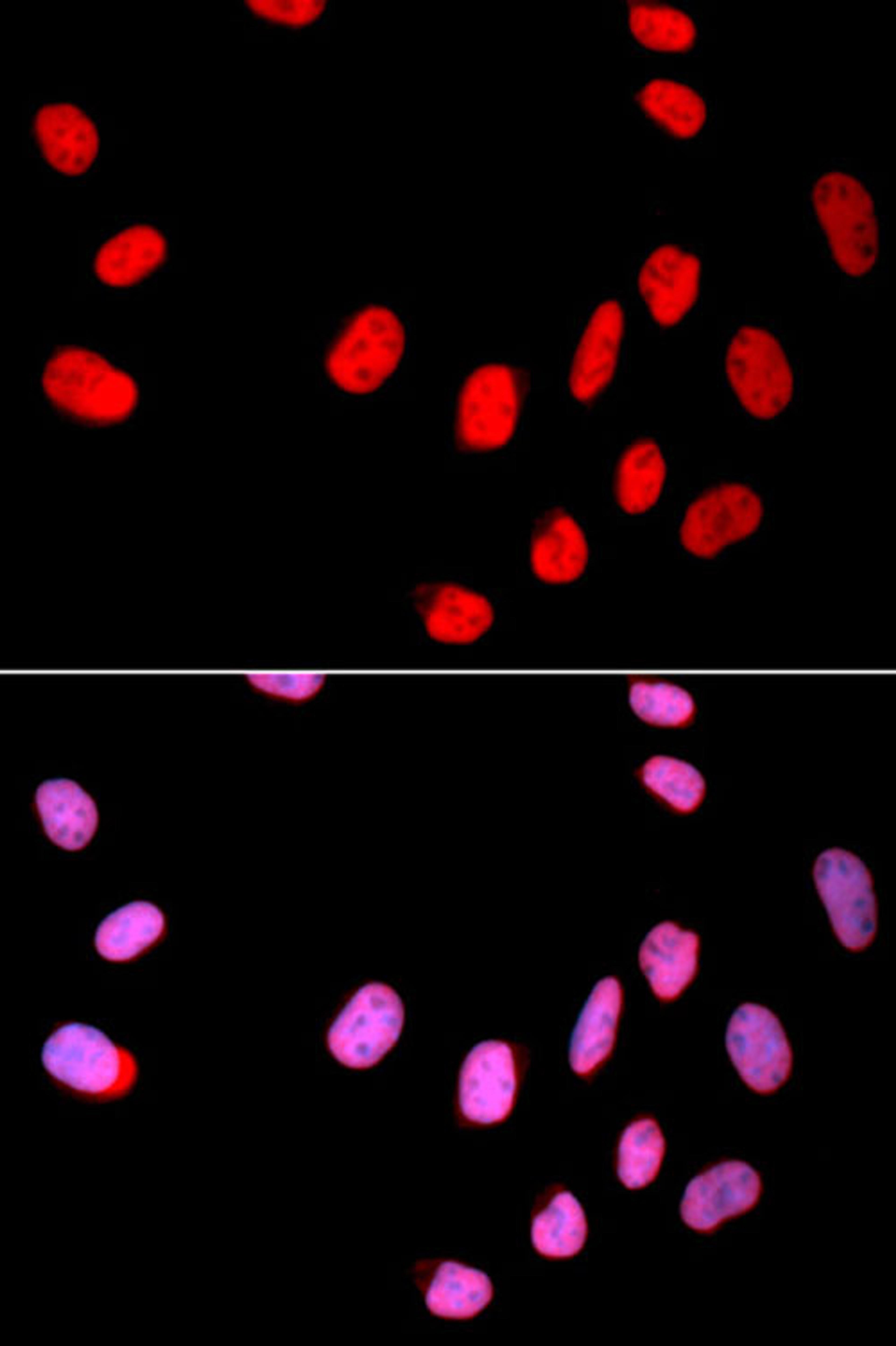 Immunofluorescence - CDC25C antibody (A11328)