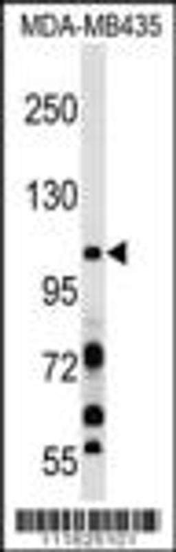 Western blot analysis in MDA-MB435 cell line lysates (35ug/lane).This demonstrates the PIK3CB antibody detected the PIK3CB protein (arrow).