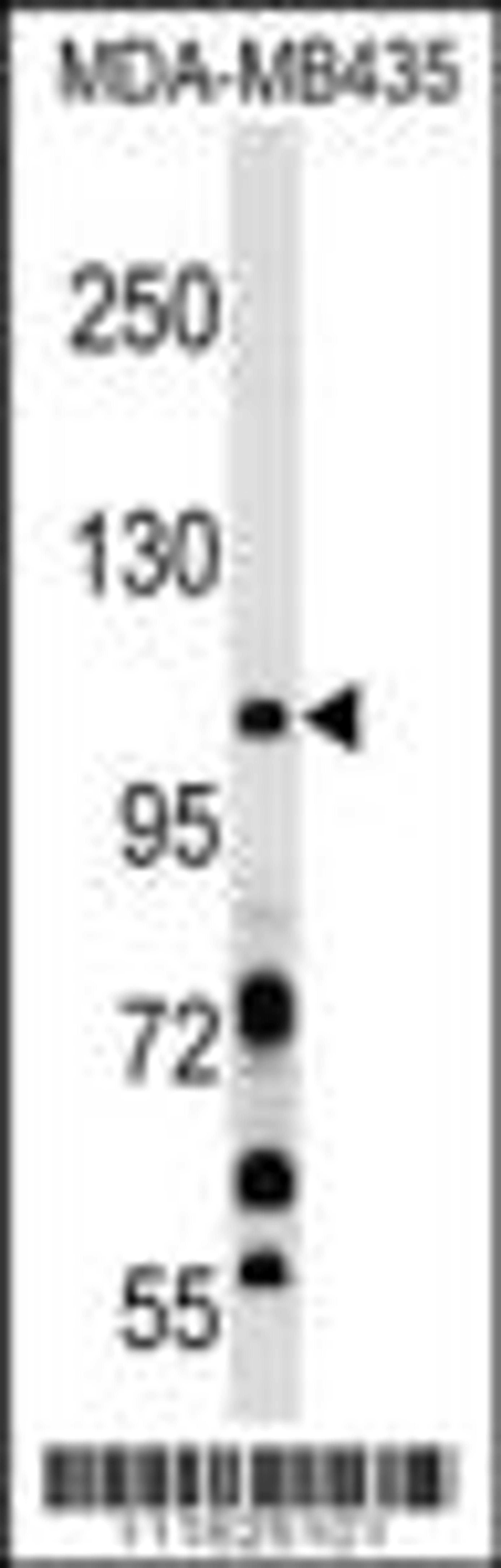 Western blot analysis in MDA-MB435 cell line lysates (35ug/lane).This demonstrates the PIK3CB antibody detected the PIK3CB protein (arrow).