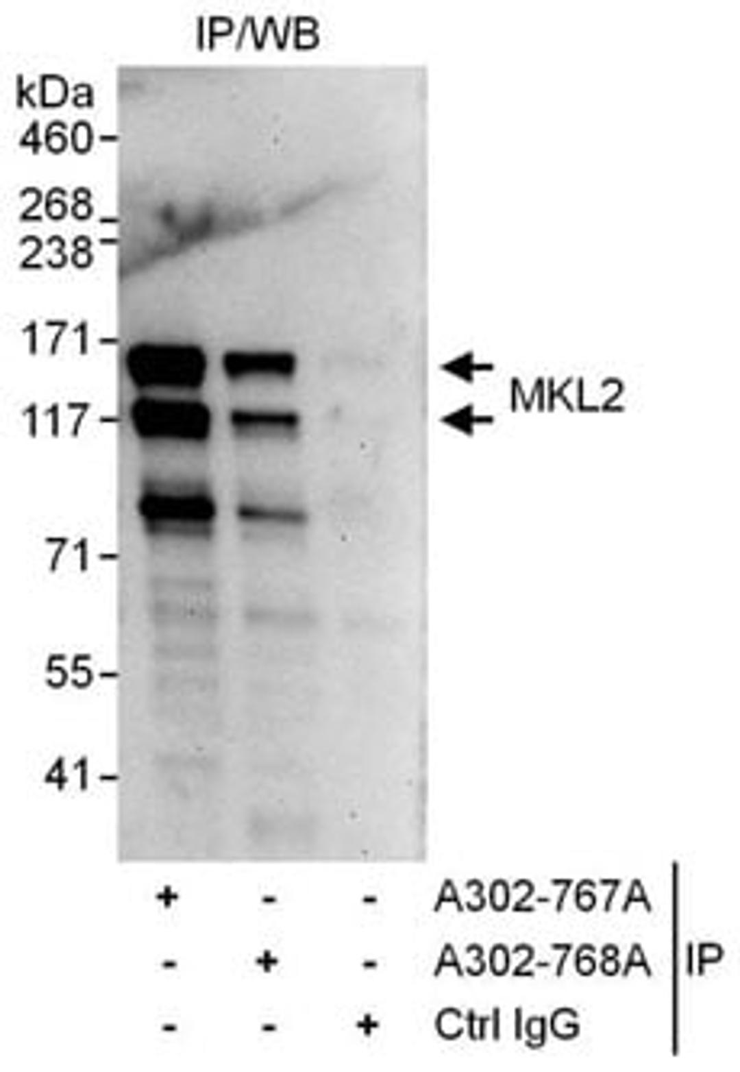 Detection of human MKL2 by western blot of immunoprecipitates.