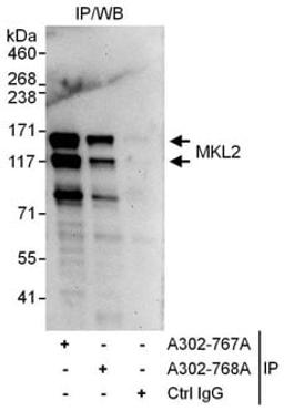 Detection of human MKL2 by western blot of immunoprecipitates.