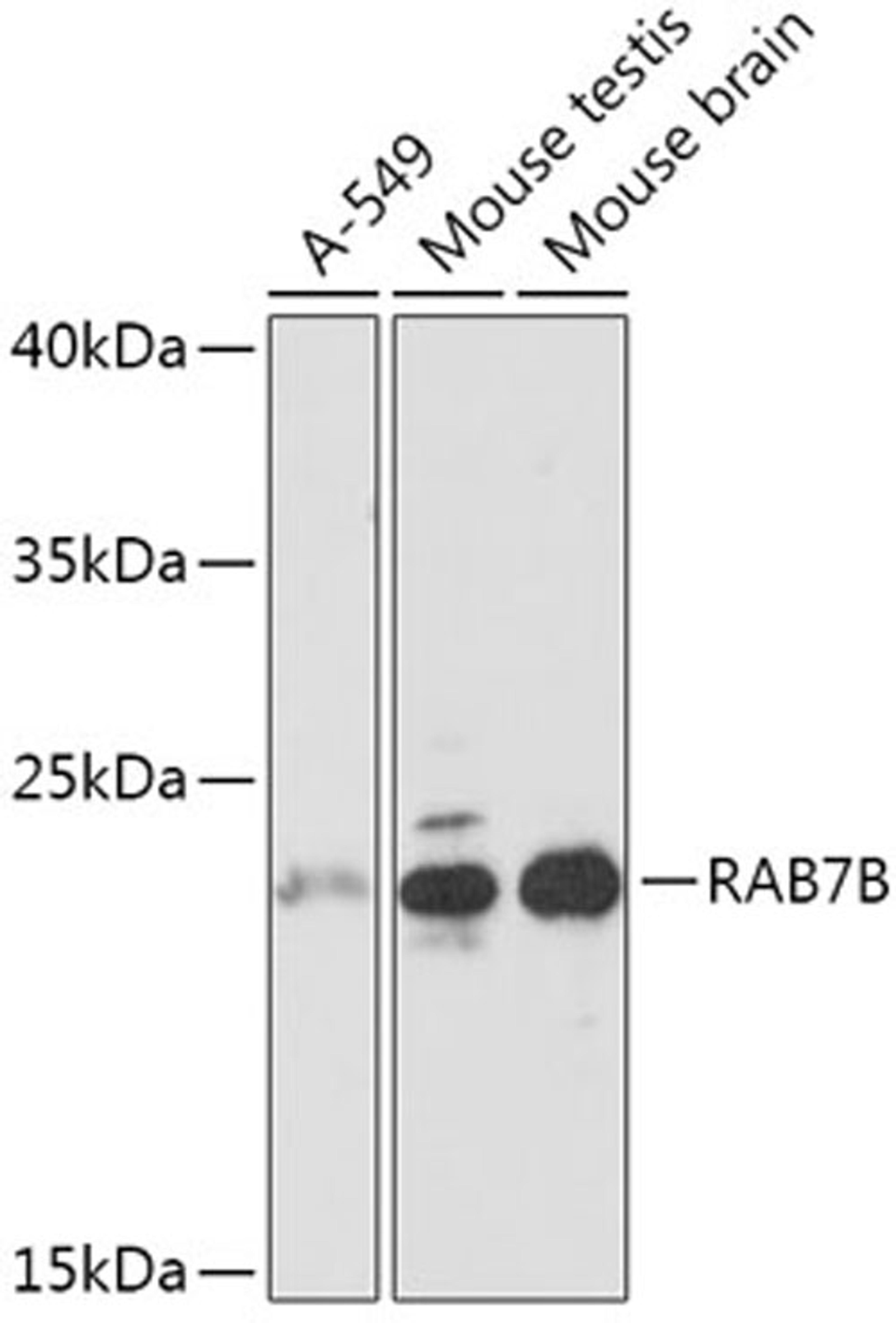 Western blot - RAB7B antibody (A17855)