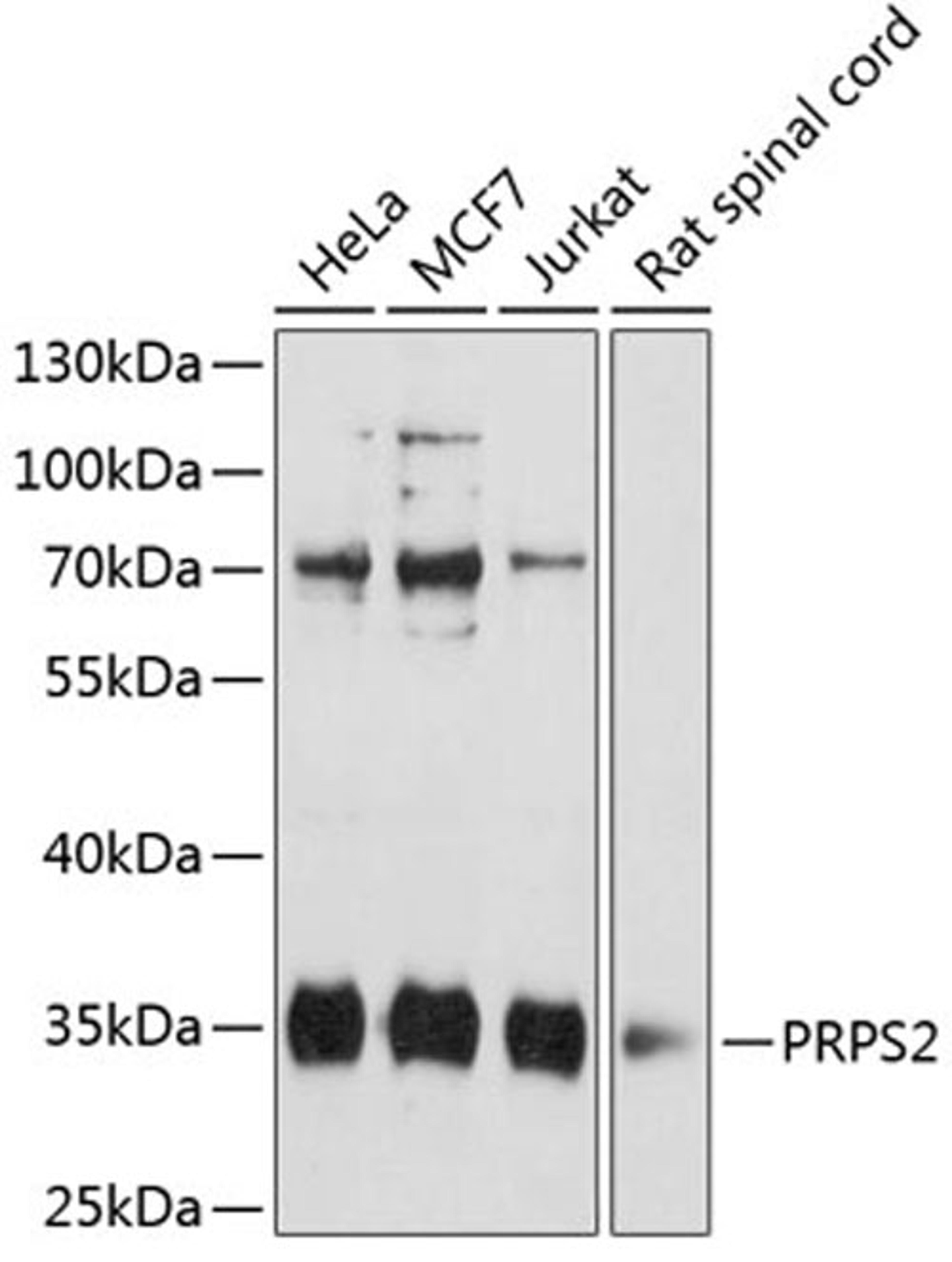 Western blot - PRPS2 antibody (A12645)