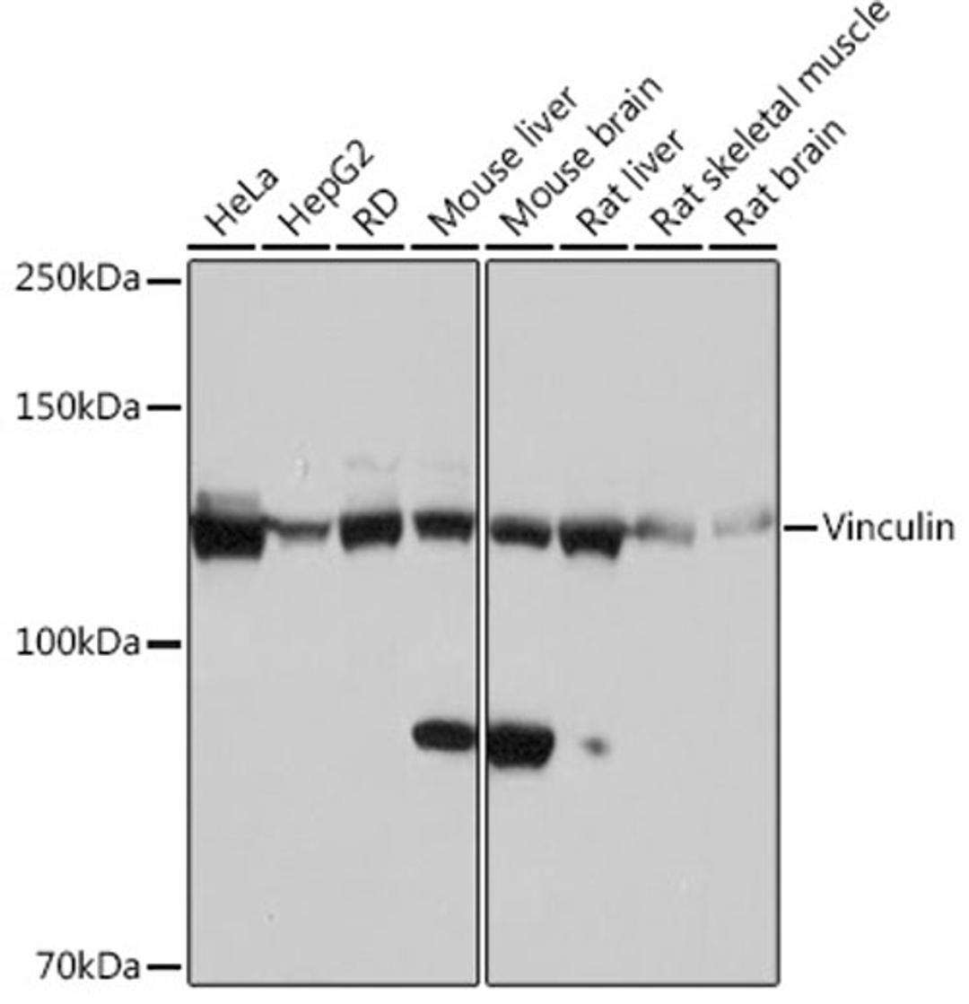 Western blot - Vinculin Rabbit mAb (A2752)