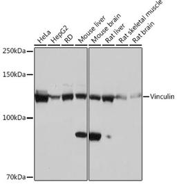 Western blot - Vinculin Rabbit mAb (A2752)