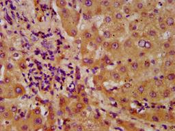 IHC image of CSB-PA891535LA01HU diluted at 1:600 and staining in paraffin-embedded human liver tissue performed on a Leica BondTM system. After dewaxing and hydration, antigen retrieval was mediated by high pressure in a citrate buffer (pH 6.0). Section was blocked with 10% normal goat serum 30min at RT. Then primary antibody (1% BSA) was incubated at 4°C overnight. The primary is detected by a biotinylated secondary antibody and visualized using an HRP conjugated SP system.