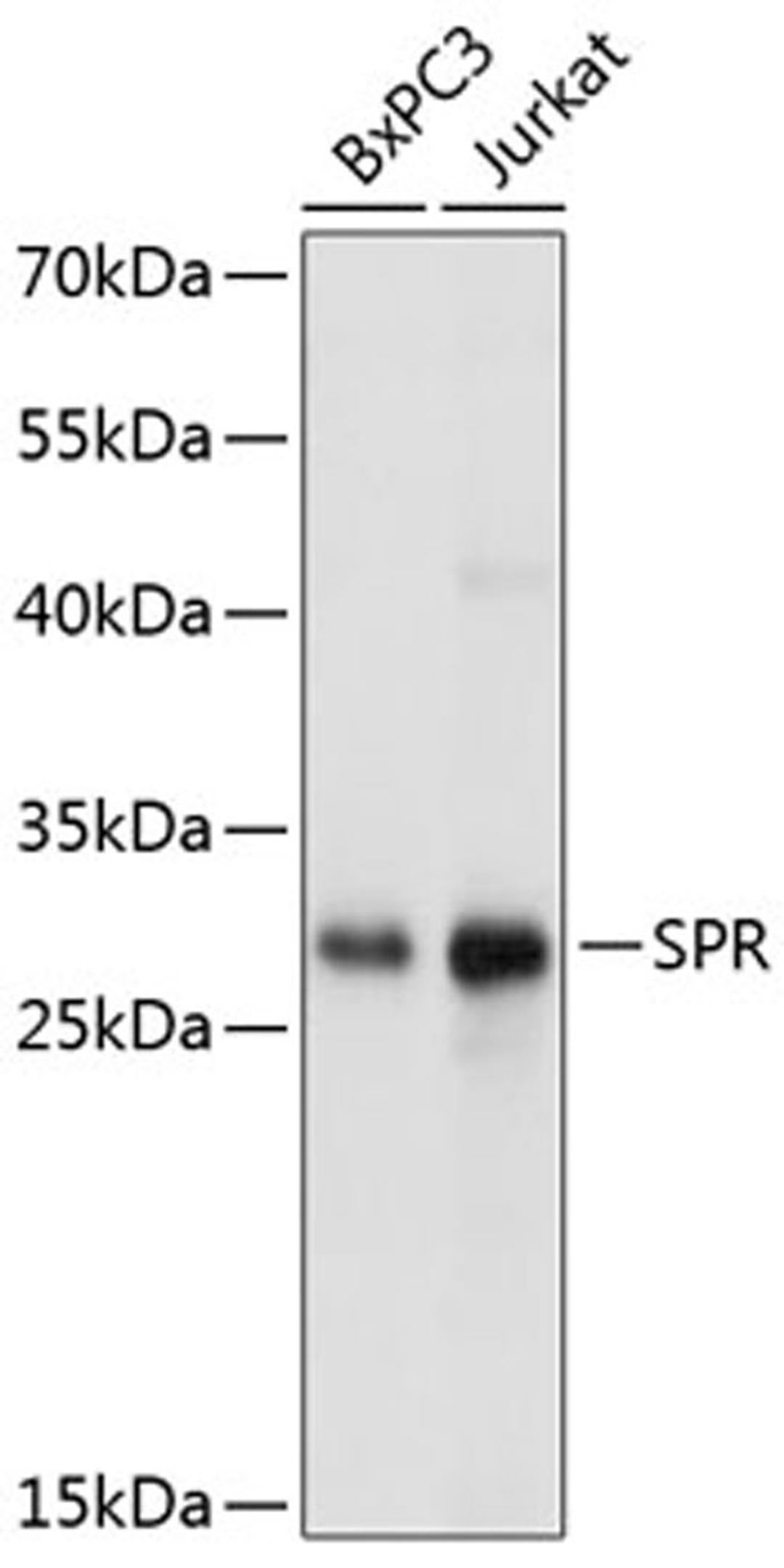 Western blot - SPR Antibody (A11694)