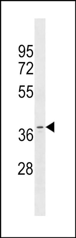 Western blot analysis in MDA-MB453 cell line lysates (35ug/lane).