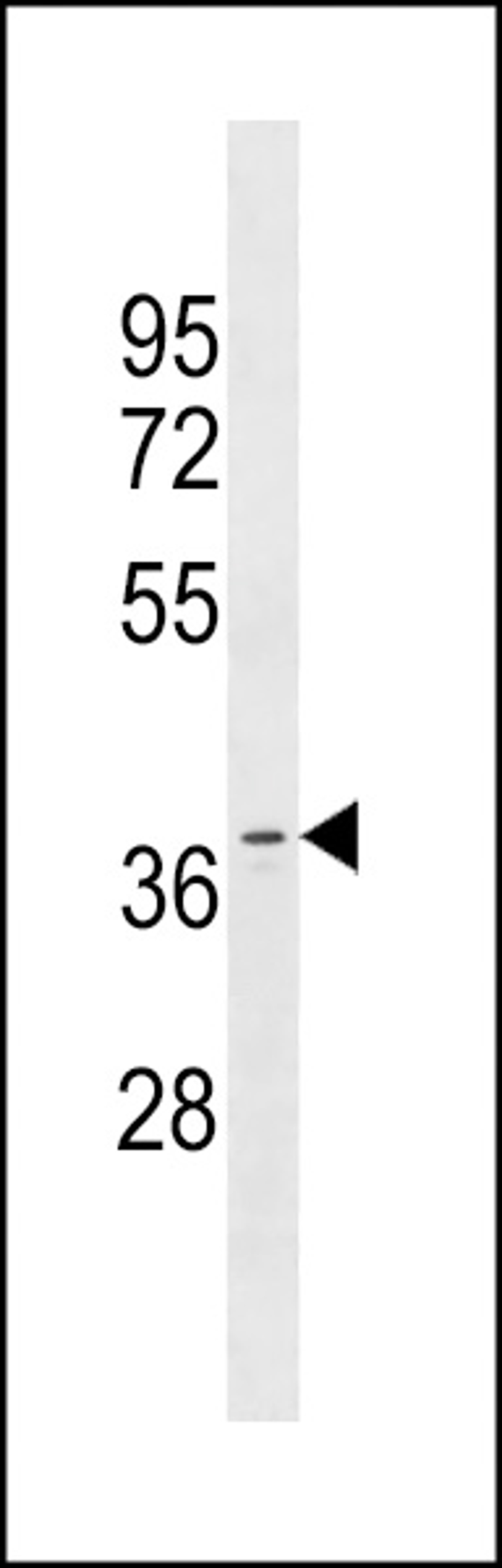 Western blot analysis in MDA-MB453 cell line lysates (35ug/lane).