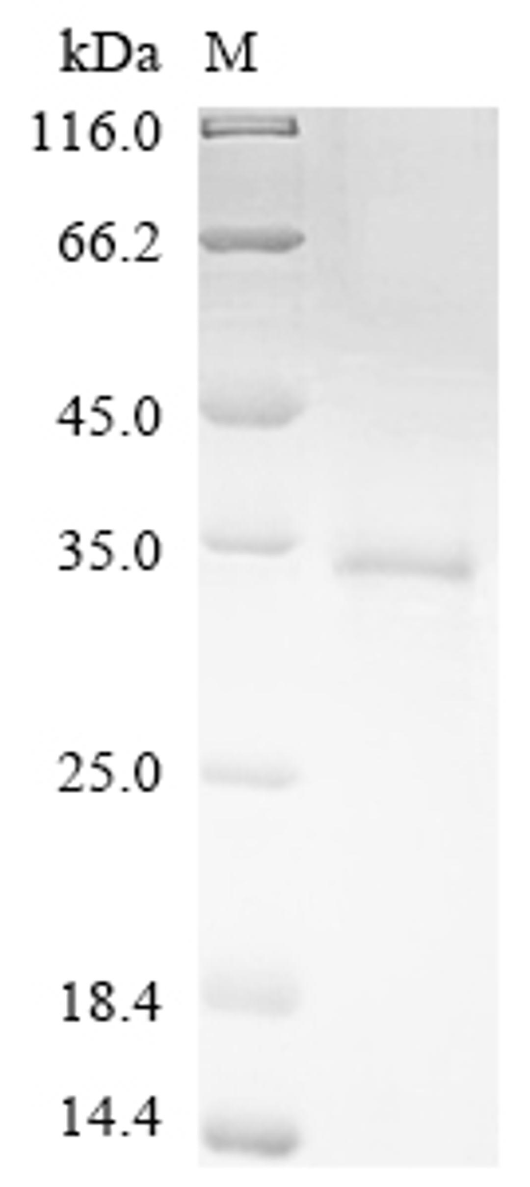 (Tris-Glycine gel) Discontinuous SDS-PAGE (reduced) with 5% enrichment gel and 15% separation gel.