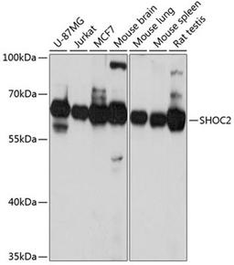 Western blot - SHOC2 Antibody (A4199)