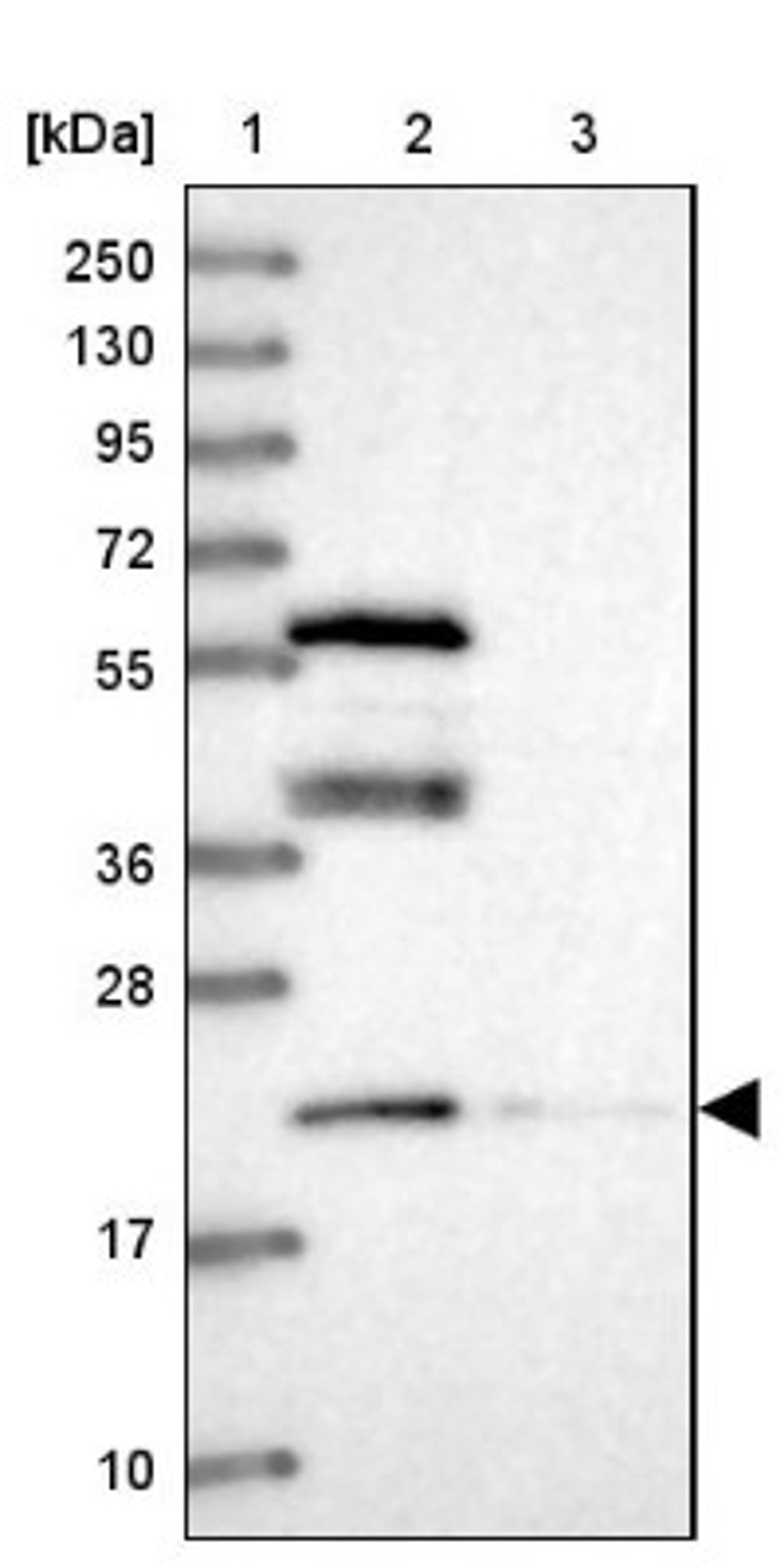 Western Blot: PTPMT1 Antibody [NBP2-13827] - Lane 1: Marker [kDa] 250, 130, 95, 72, 55, 36, 28, 17, 10<br/>Lane 2: Human cell line RT-4<br/>Lane 3: Human cell line U-251MG sp