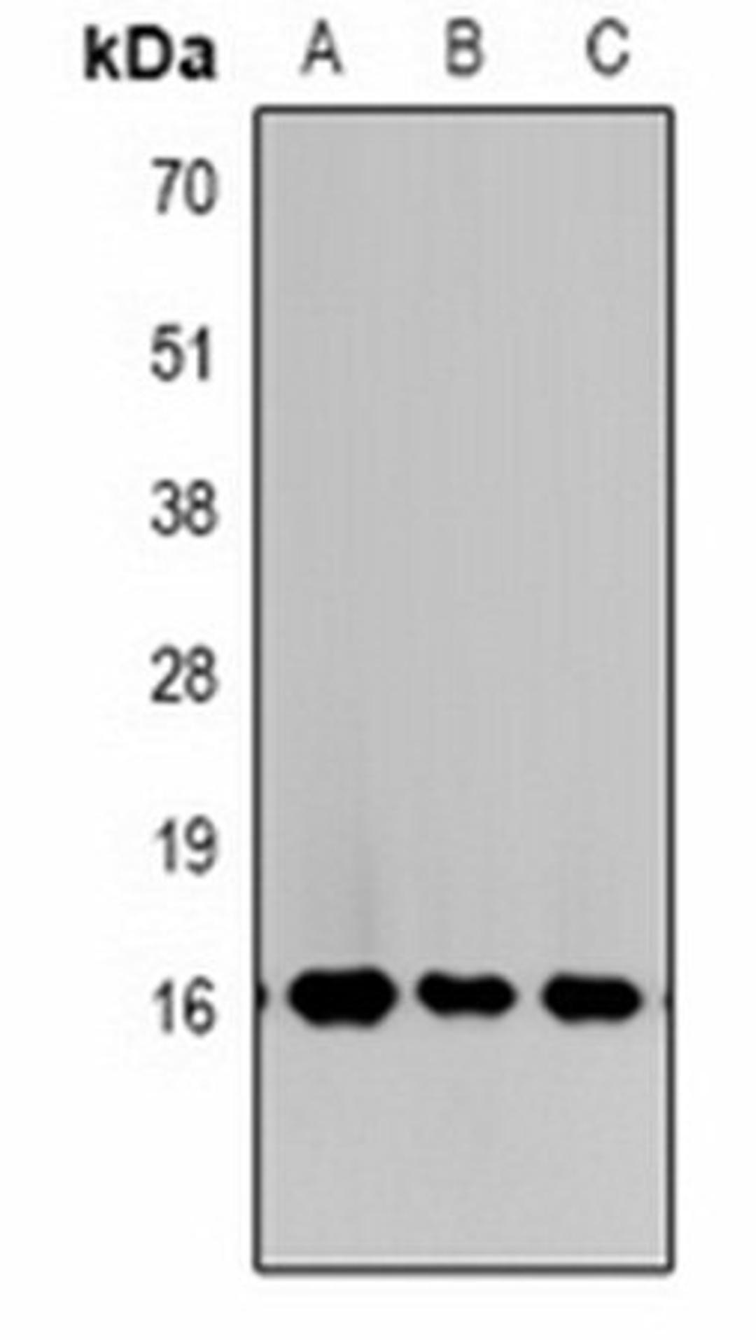 Western blot analysis of  Hela (Lane1), NIH3T3 (Lane2), rat liver (Lane3) whole cell lysates using Histone H3 (TriMethyl K27) antibody