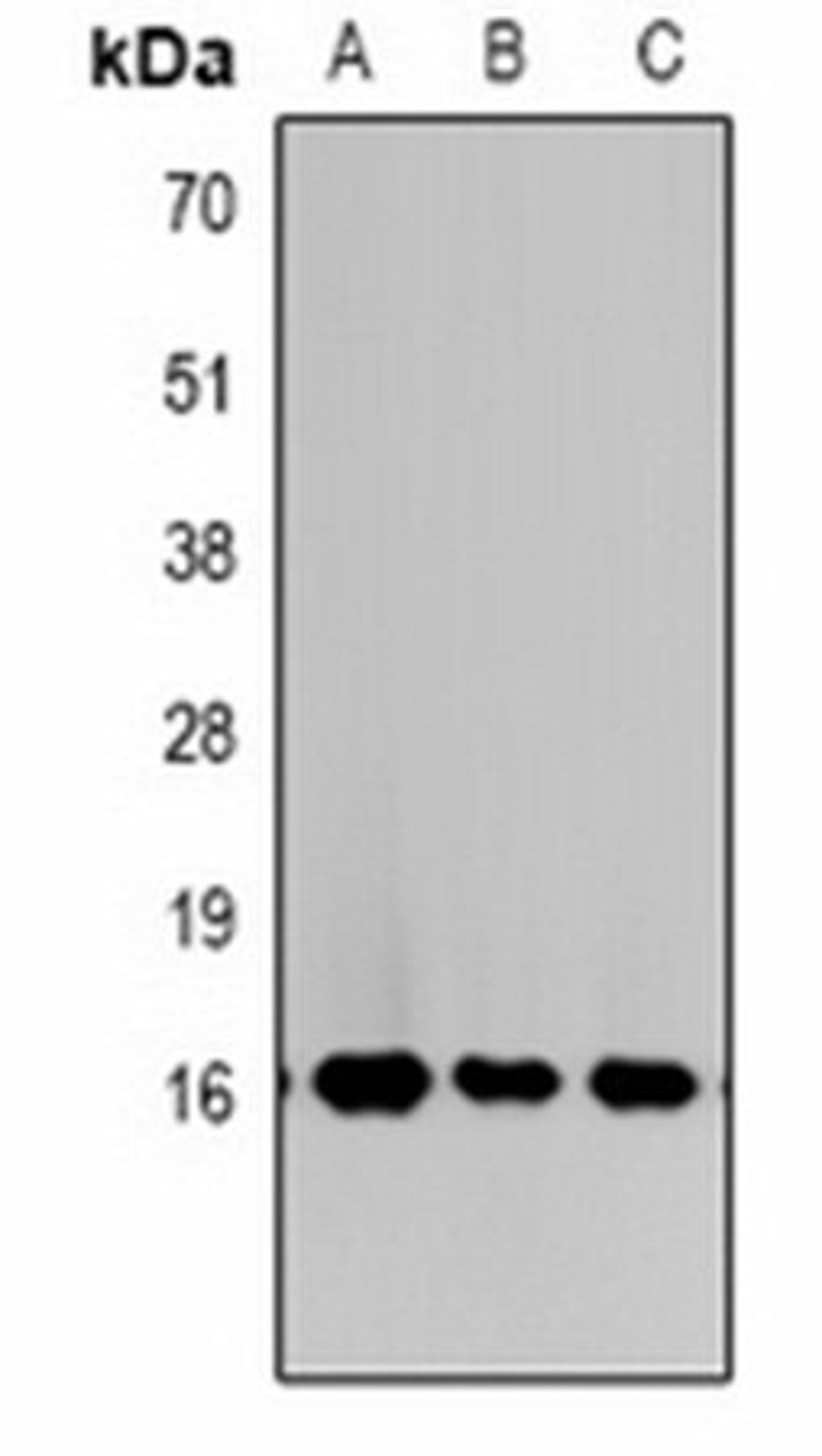 Western blot analysis of  Hela (Lane1), NIH3T3 (Lane2), rat liver (Lane3) whole cell lysates using Histone H3 (TriMethyl K27) antibody