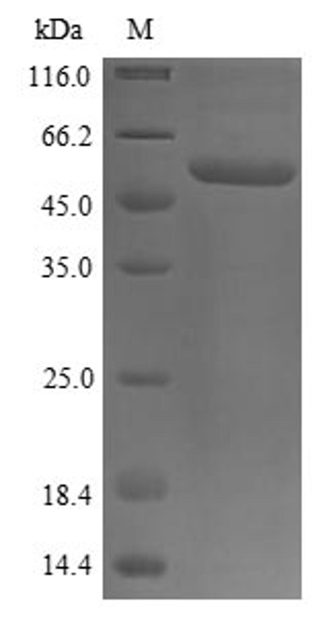 (Tris-Glycine gel) Discontinuous SDS-PAGE (reduced) with 5% enrichment gel and 15% separation gel.