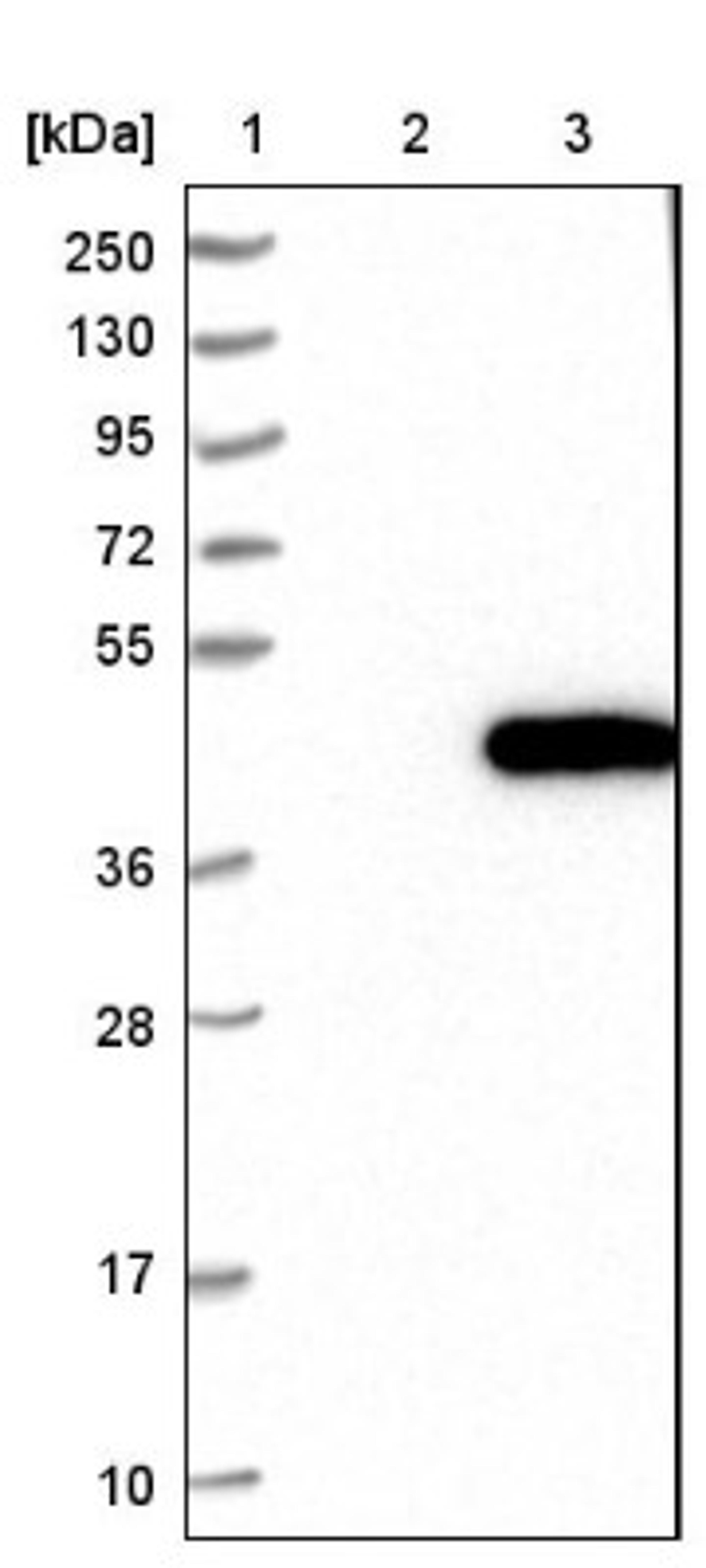 Western Blot: ATP6V0D1 Antibody [NBP1-88893] - Lane 1: Marker [kDa] 250, 130, 95, 72, 55, 36, 28, 17, 10<br/>Lane 2: Negative control (vector only transfected HEK293T lysate)<br/>Lane 3: Over-expression lysate (Co-expressed with a C-terminal myc-DDK tag (~3.1 kDa) in mammalian HEK293T cells, LY417820)