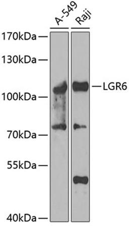 Western blot - LGR6 antibody (A7383)