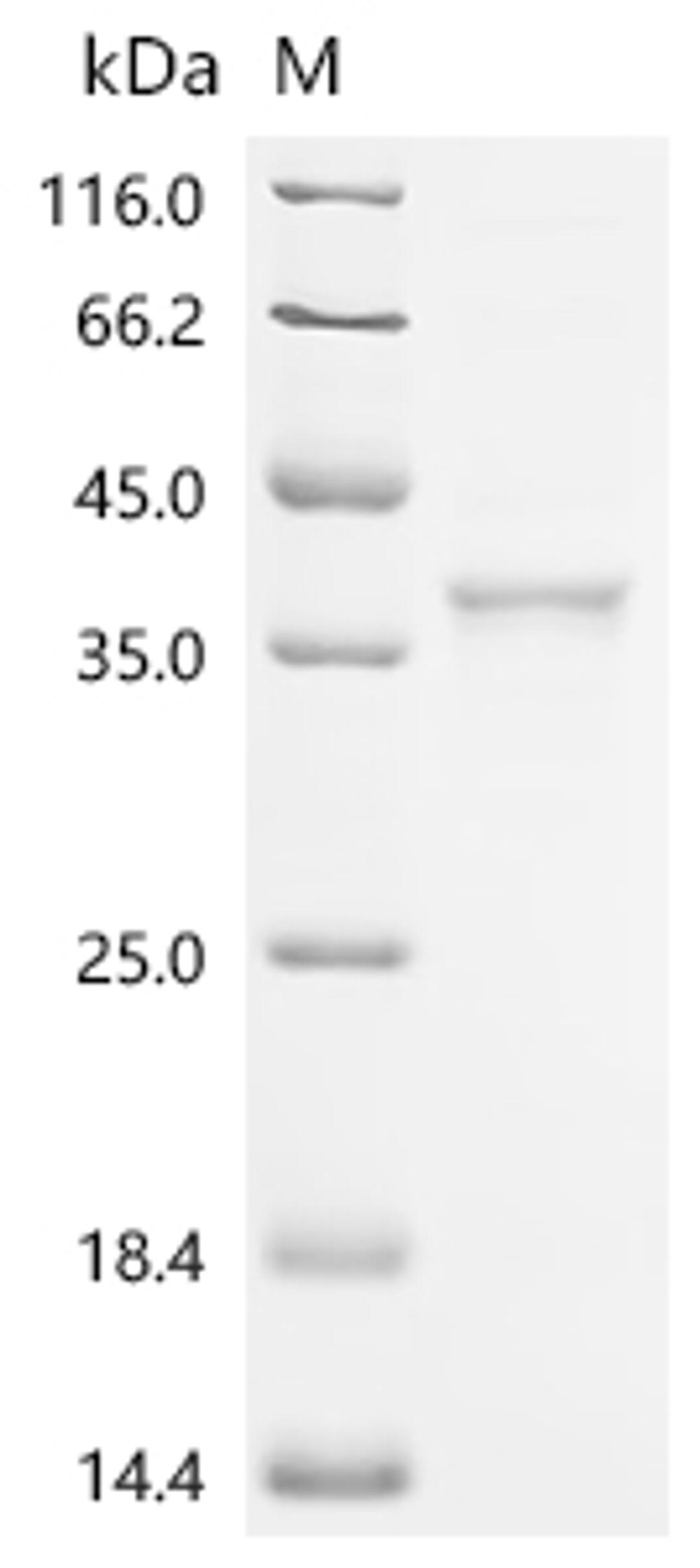(Tris-Glycine gel) Discontinuous SDS-PAGE (reduced) with 5% enrichment gel and 15% separation gel.