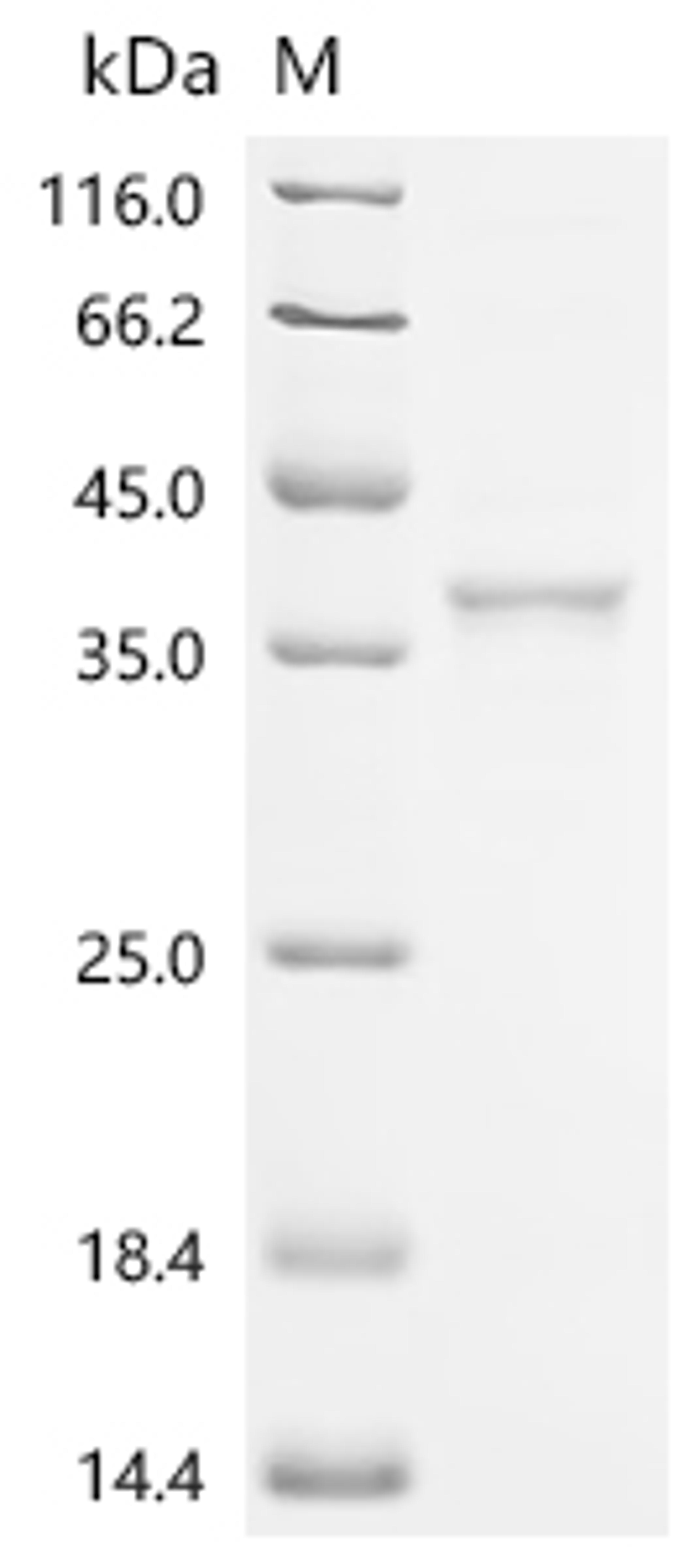 (Tris-Glycine gel) Discontinuous SDS-PAGE (reduced) with 5% enrichment gel and 15% separation gel.