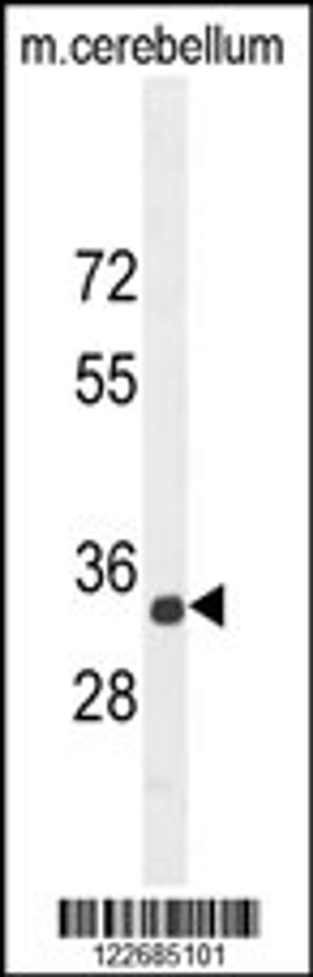 Western blot analysis in mouse cerebellum tissue lysates (35ug/lane).