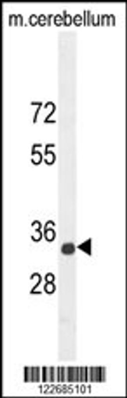 Western blot analysis in mouse cerebellum tissue lysates (35ug/lane).