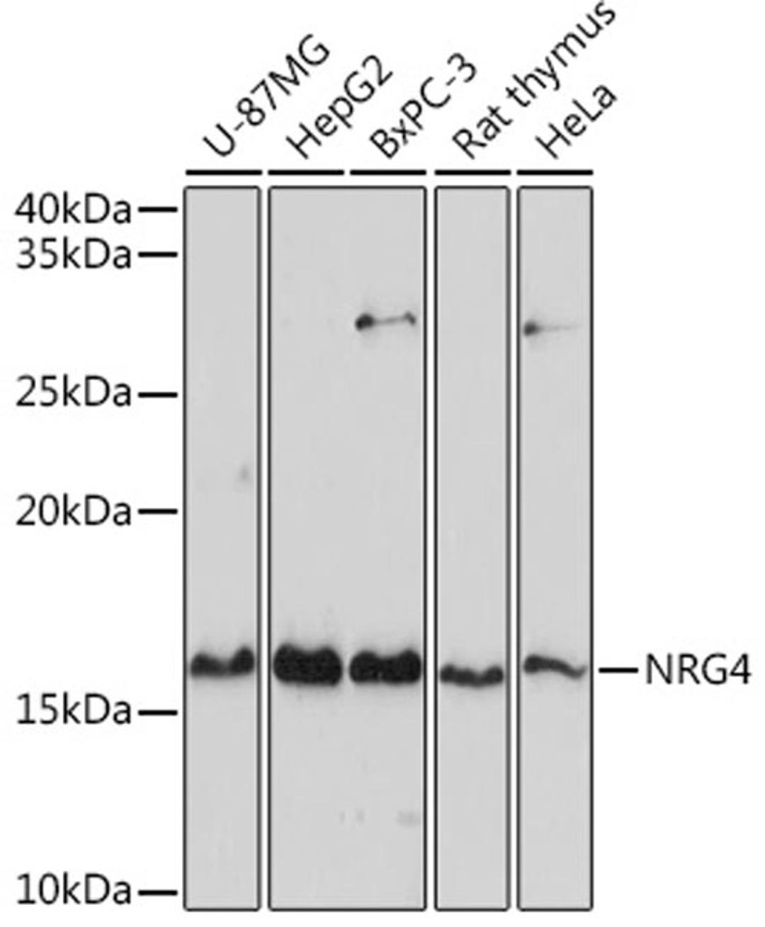 Western blot - NRG4 antibody (A2599)