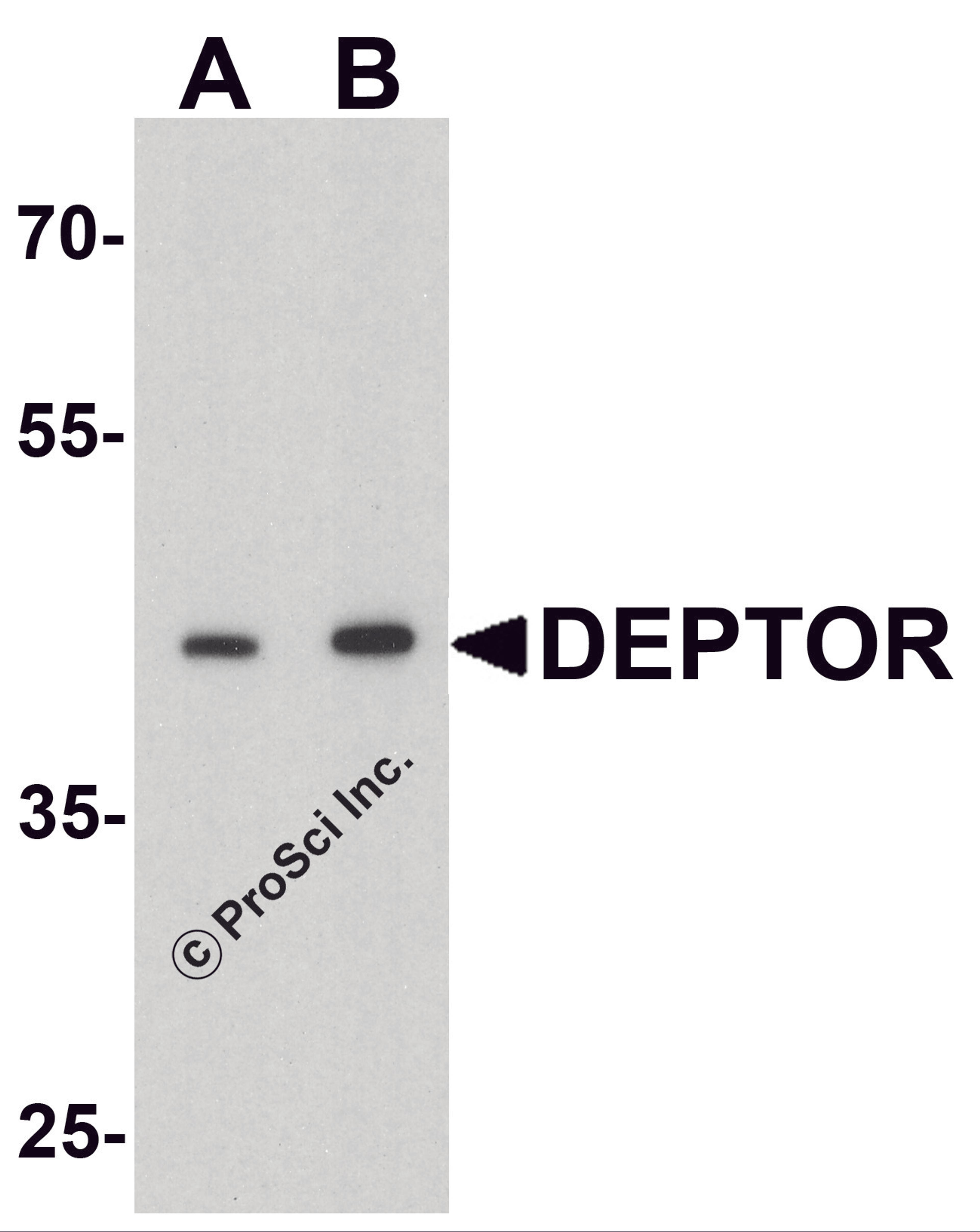 Western blot analysis of DEPTOR in mouse liver tissue lysate with DEPTOR antibody at (A) 1 and (B) 2 μg/ml.