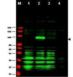 Western blot analysis of Ajuba-RFP fusion protein in cell lysates (arrow-head). 