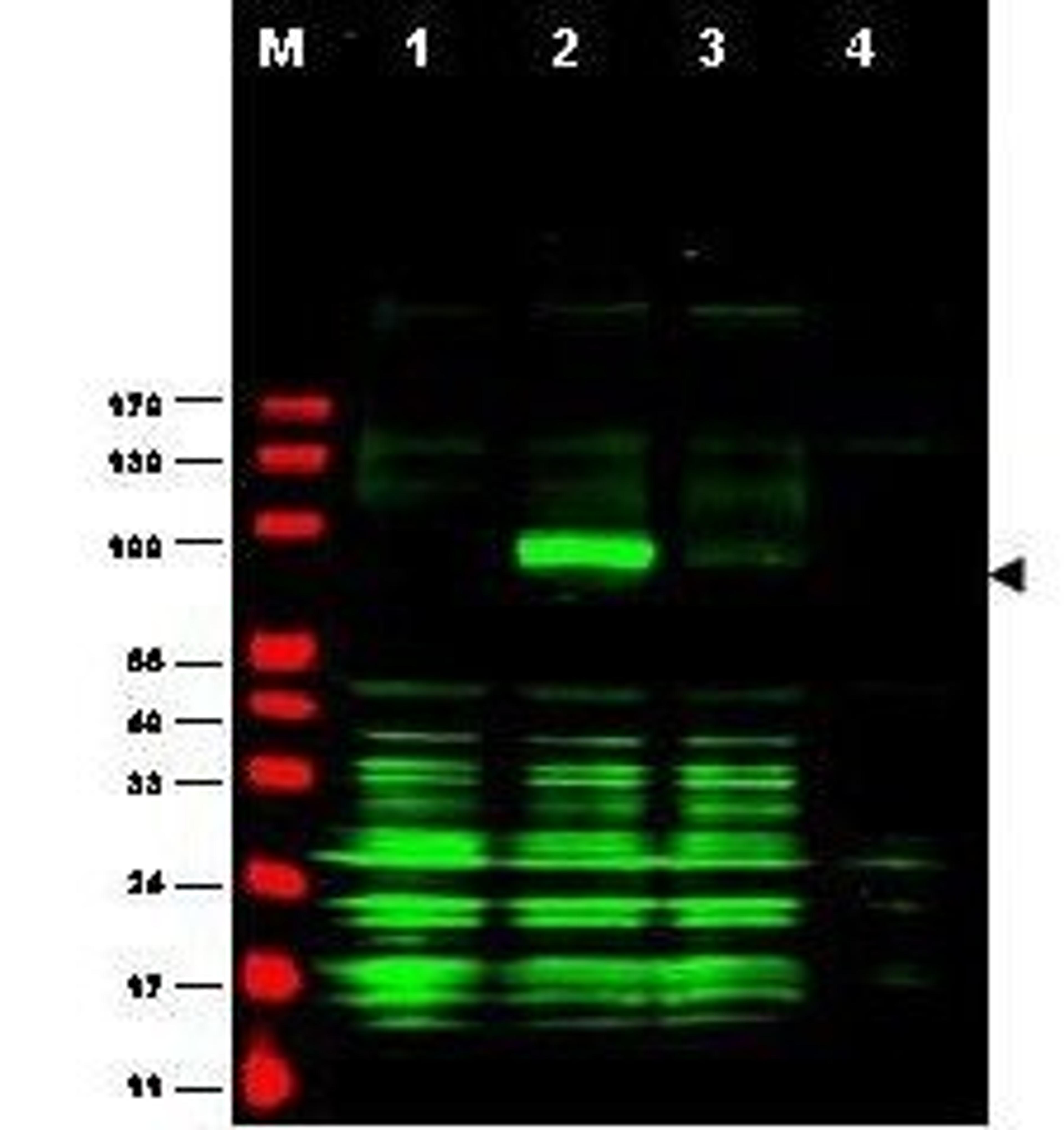 Western blot analysis of Ajuba-RFP fusion protein in cell lysates (arrow-head).