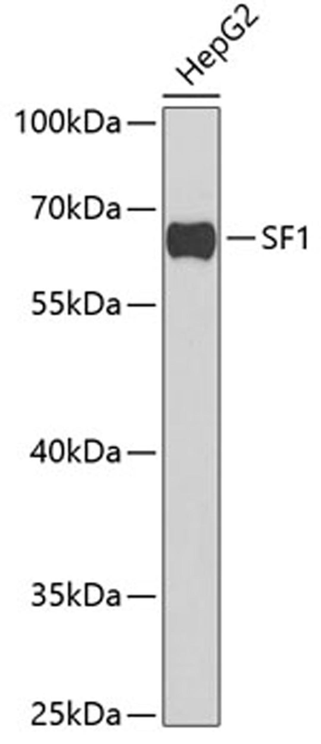 Western blot - SF1 antibody (A6424)