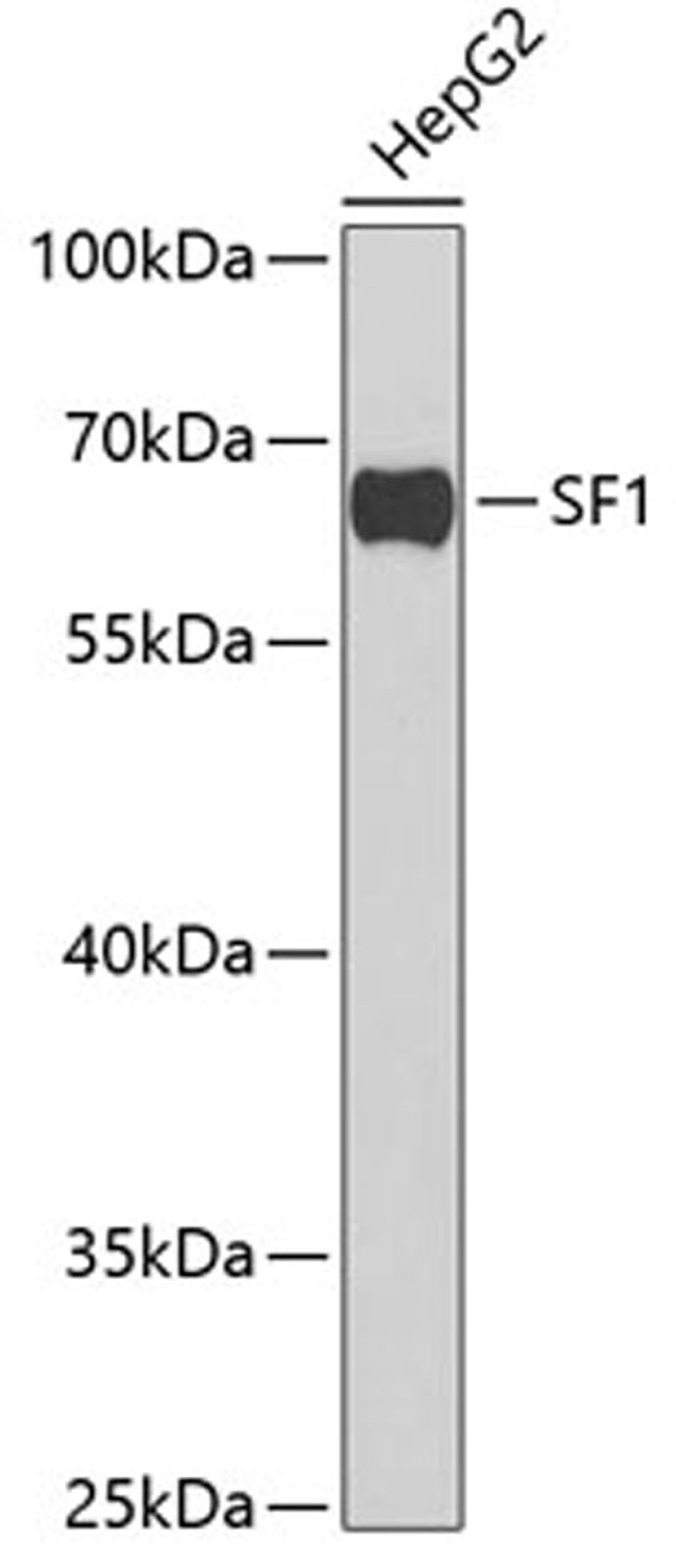 Western blot - SF1 antibody (A6424)