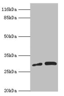 Western blot. All lanes: PSMF1 antibody at 1.28ug/ml. Lane 1: A549 whole cell lysate. Lane 2: K562 whole cell lysate. Secondary. Goat polyclonal to rabbit IgG at 1/10000 dilution. Predicted band size: 30 kDa. Observed band size: 30 kDa.