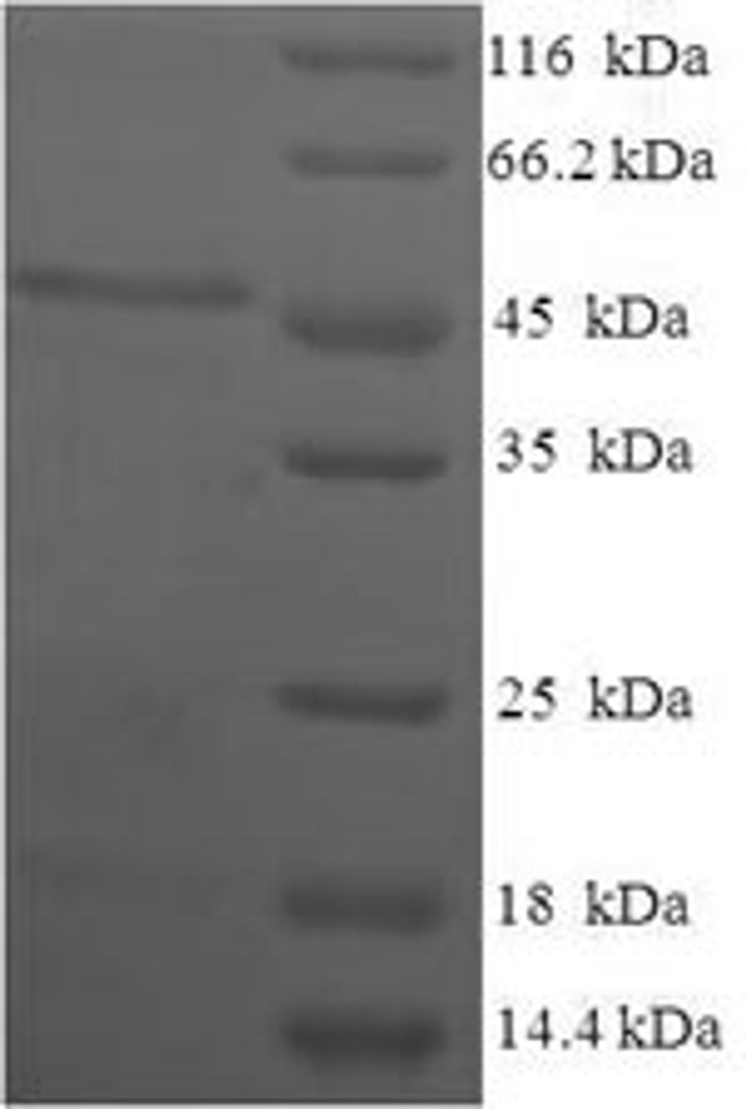 (Tris-Glycine gel) Discontinuous SDS-PAGE (reduced) with 5% enrichment gel and 15% separation gel.