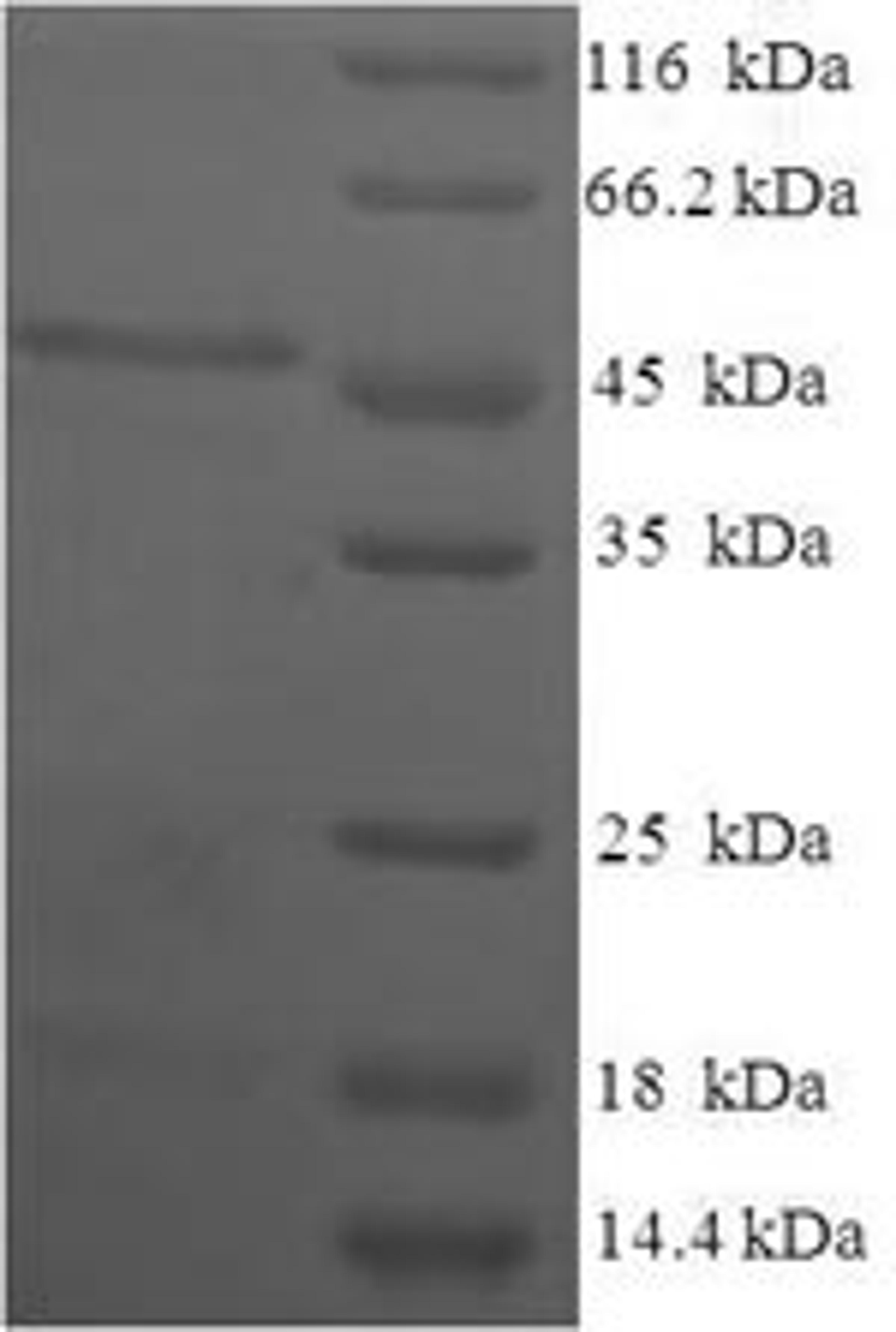 (Tris-Glycine gel) Discontinuous SDS-PAGE (reduced) with 5% enrichment gel and 15% separation gel.