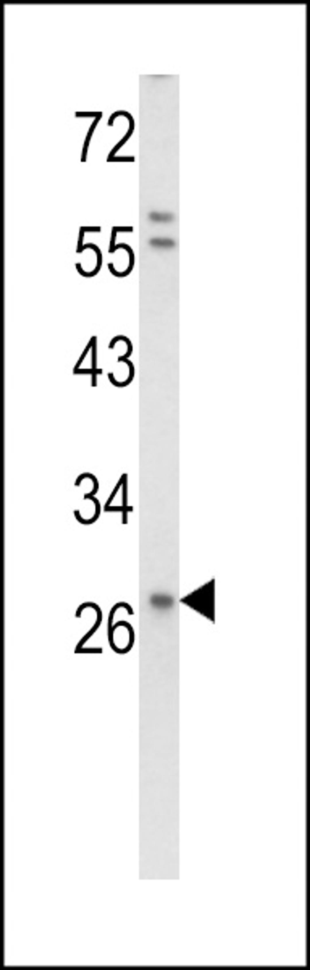 Western blot analysis of in HepG2 cell line lysates (35ug/lane)