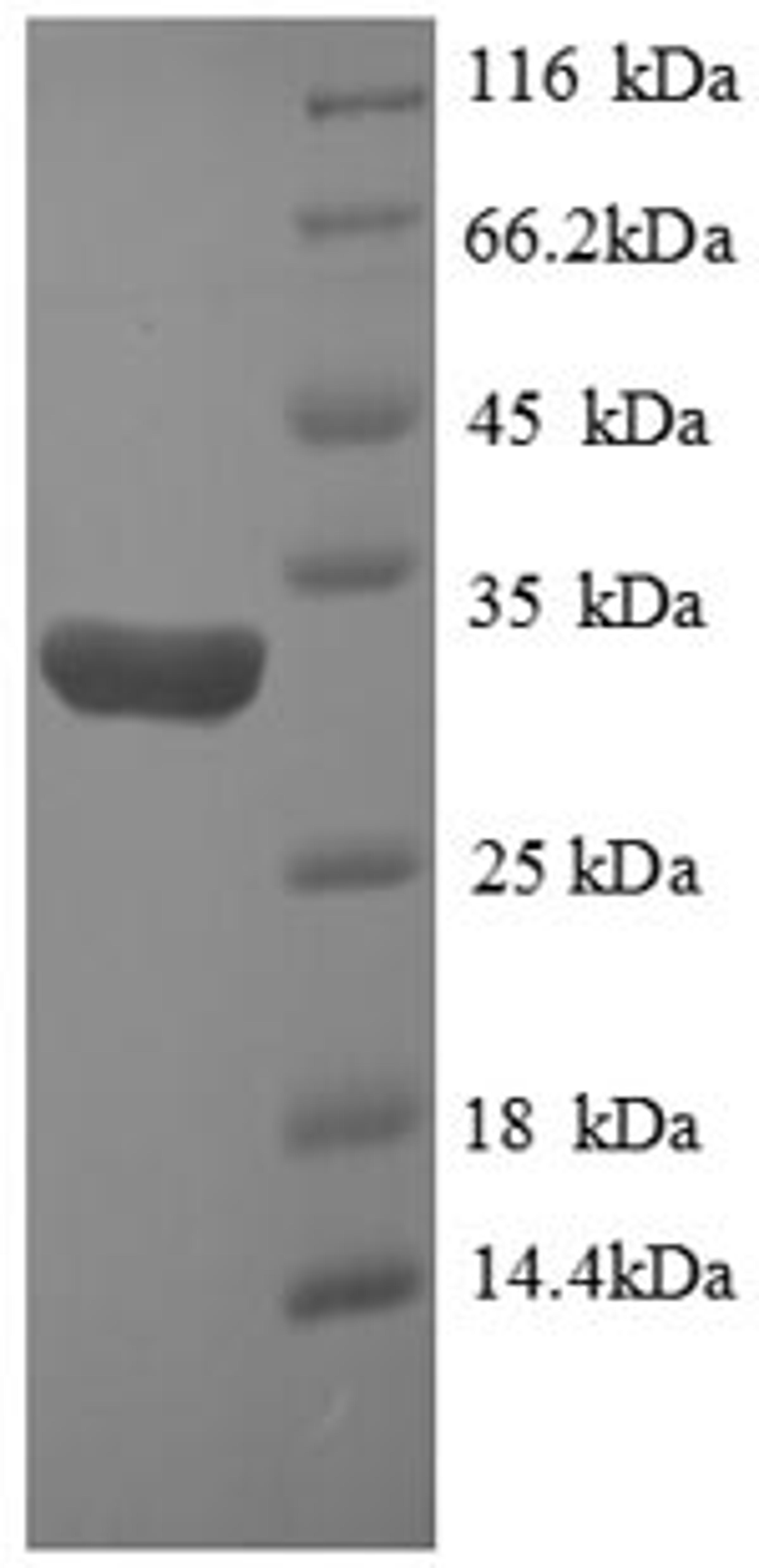 (Tris-Glycine gel) Discontinuous SDS-PAGE (reduced) with 5% enrichment gel and 15% separation gel.