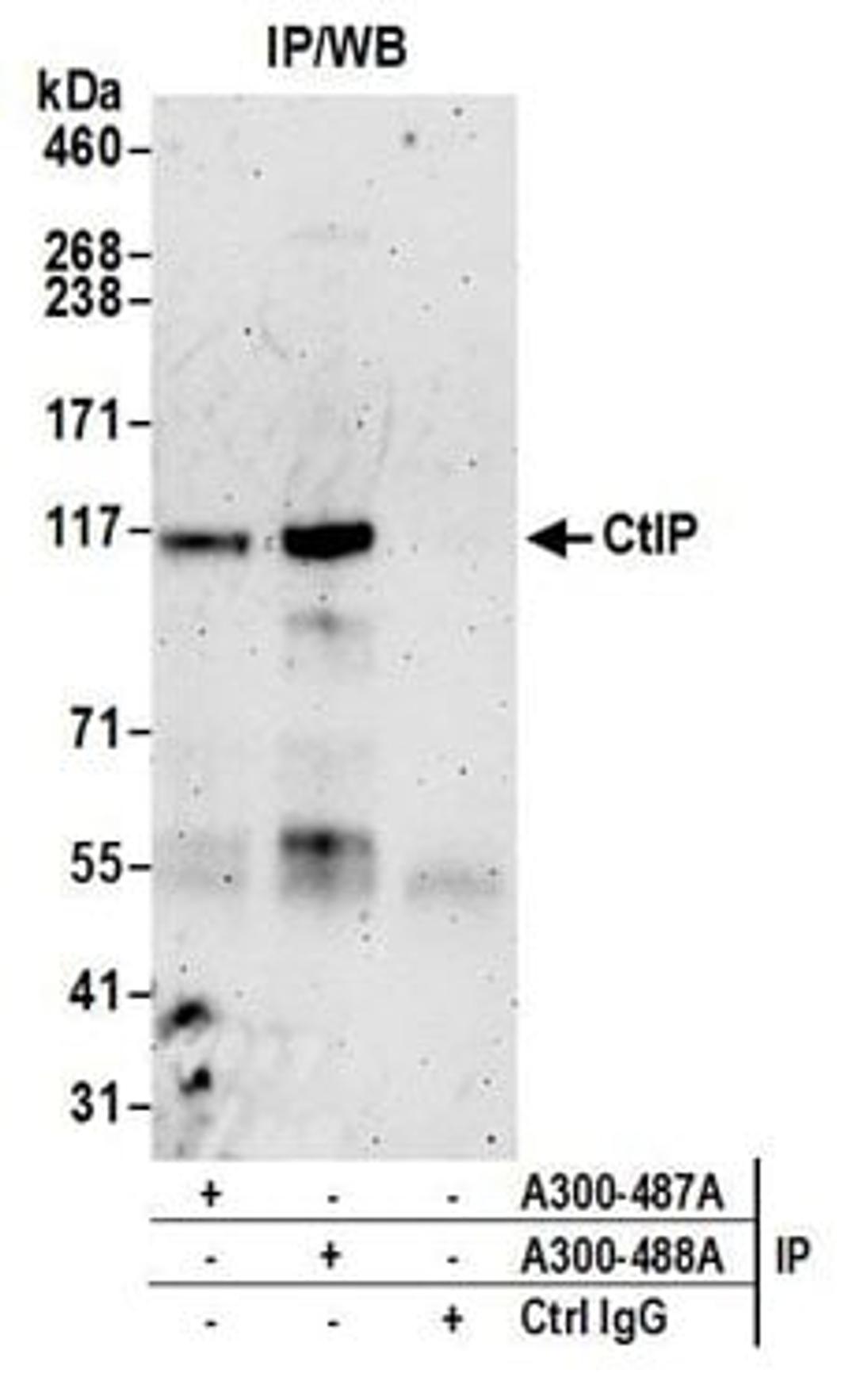 Detection of human CtIP by western blot of immunoprecipitates.