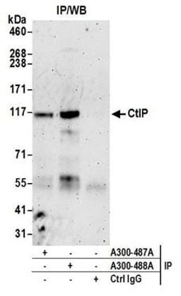 Detection of human CtIP by western blot of immunoprecipitates.