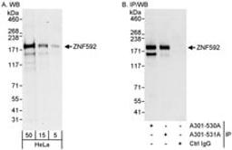 Detection of human ZNF592 by western blot and immunoprecipitation.