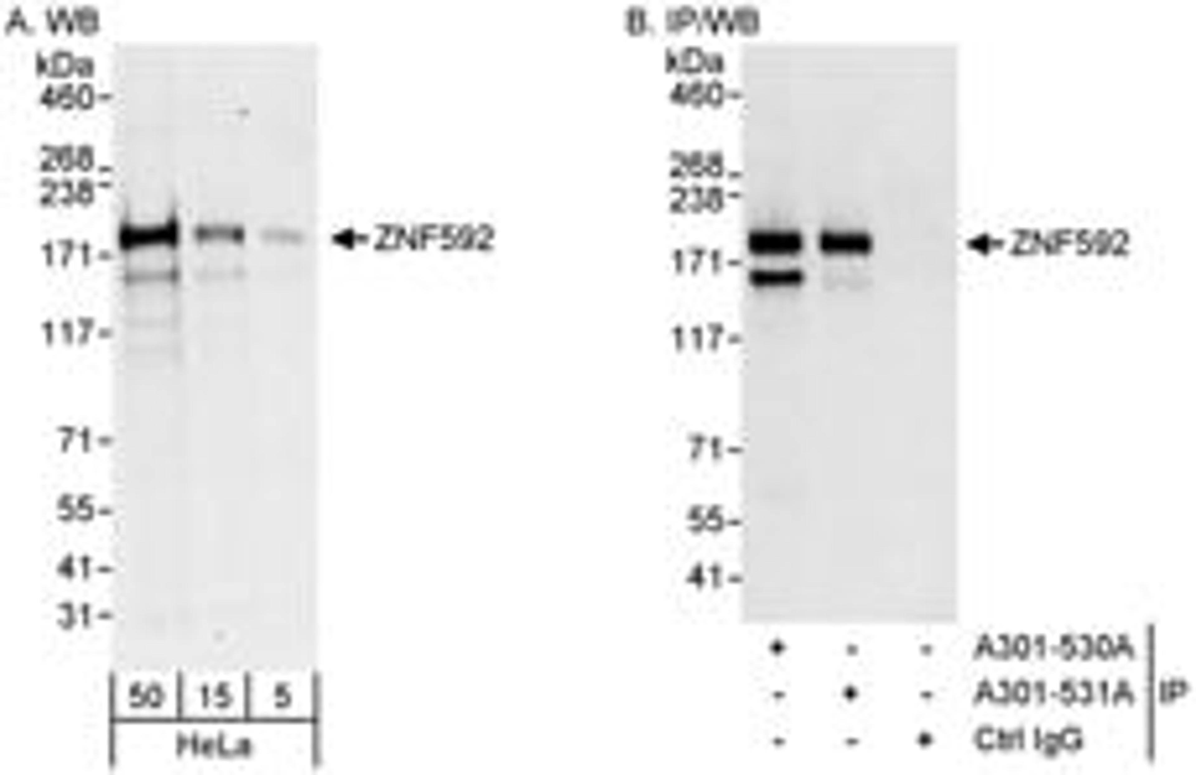 Detection of human ZNF592 by western blot and immunoprecipitation.