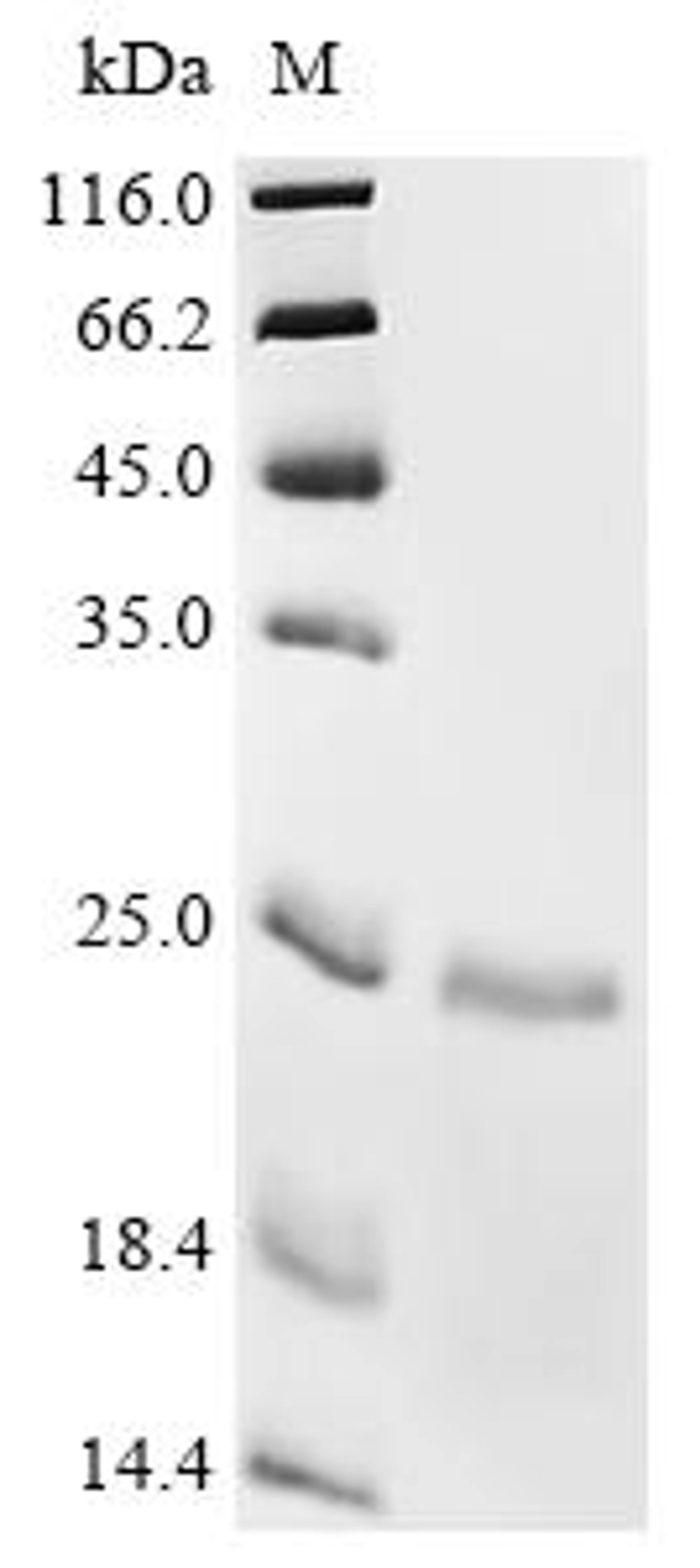 (Tris-Glycine gel) Discontinuous SDS-PAGE (reduced) with 5% enrichment gel and 15% separation gel.