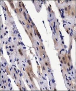 Immunohistochemistry: BMP-2 Antibody [NBP1-19751] - Analysis of BMP2 in mouse heart using DAB with hematoxylin counterstain.