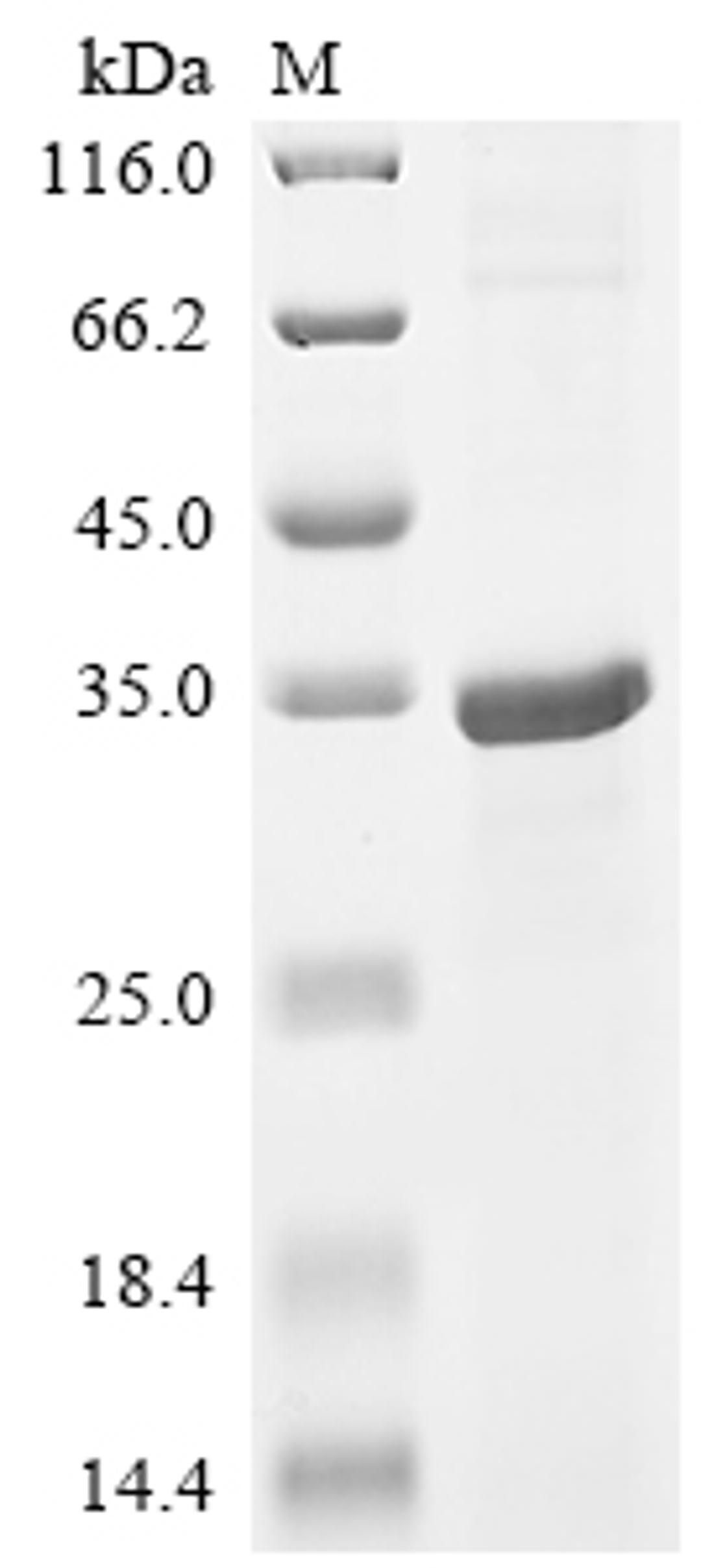 (Tris-Glycine gel) Discontinuous SDS-PAGE (reduced) with 5% enrichment gel and 15% separation gel.