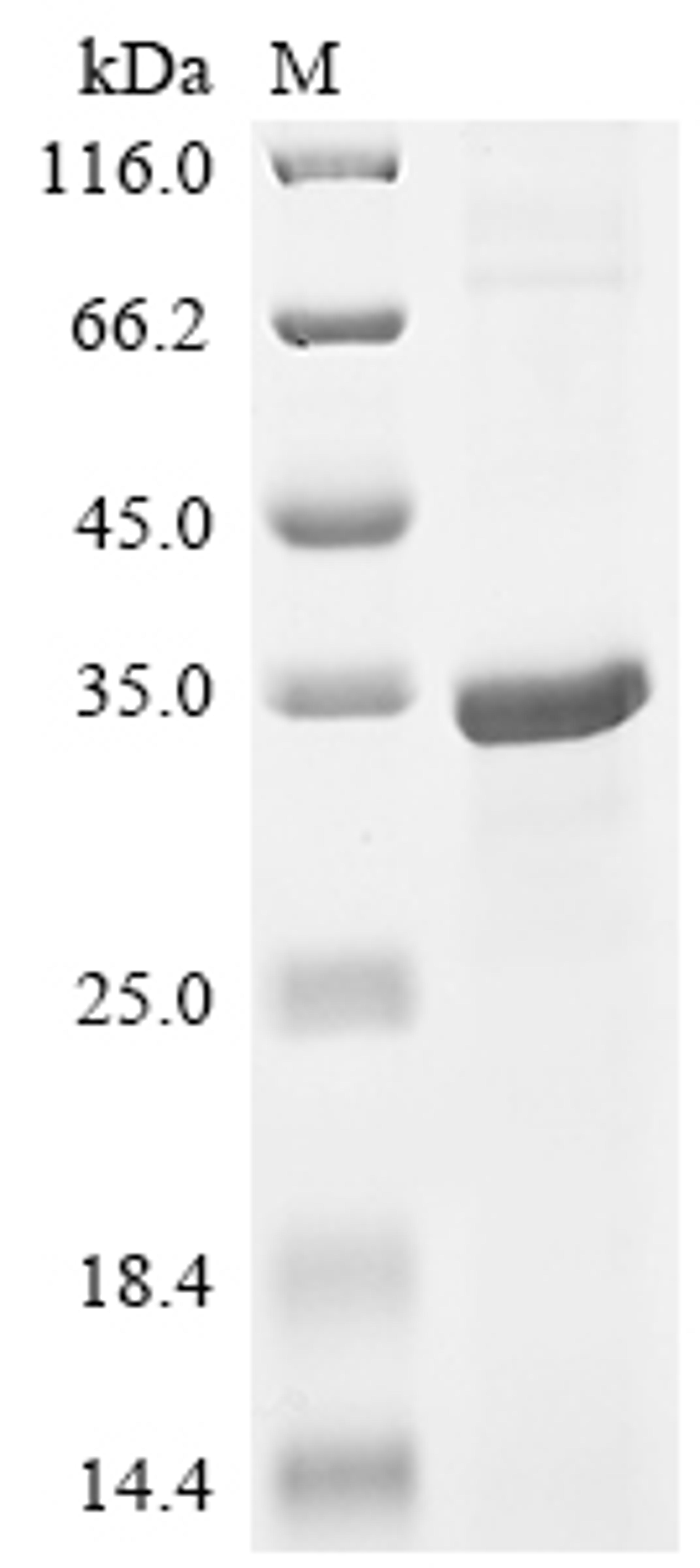 (Tris-Glycine gel) Discontinuous SDS-PAGE (reduced) with 5% enrichment gel and 15% separation gel.