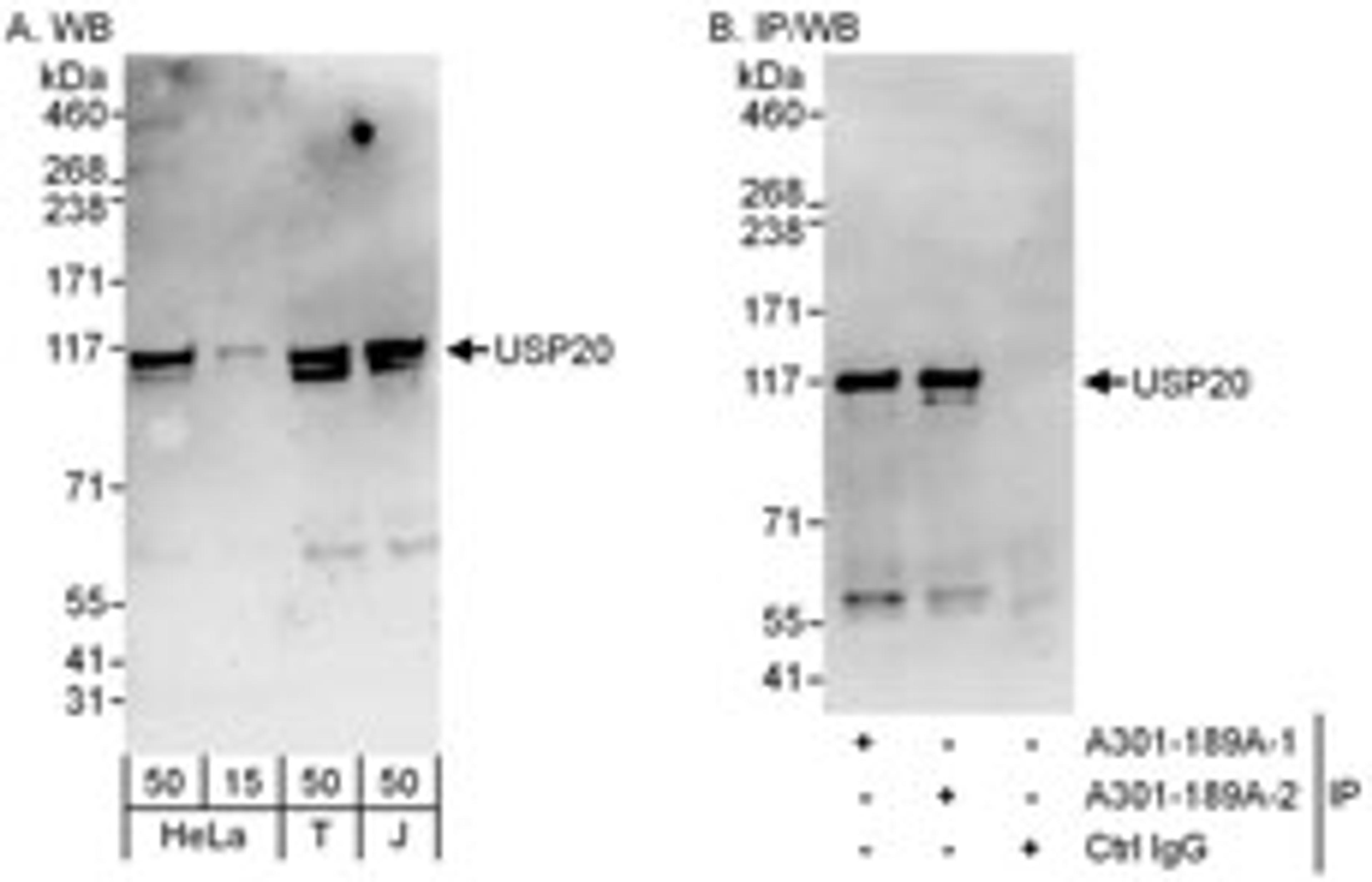 Detection of human USP20/VDU2 by western blot and immunoprecipitation.